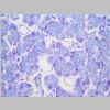 Pancreas SF 19.jpg